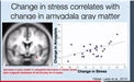 Yongey Mingyur Rinpoche: Science Shows Meditation Can Improve Our Quality of Life