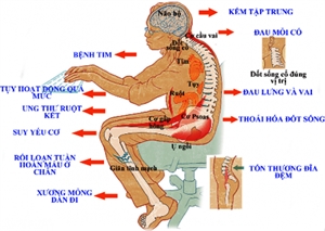 Ngồi nhiều thật không tốt cho sức khỏe của bạn